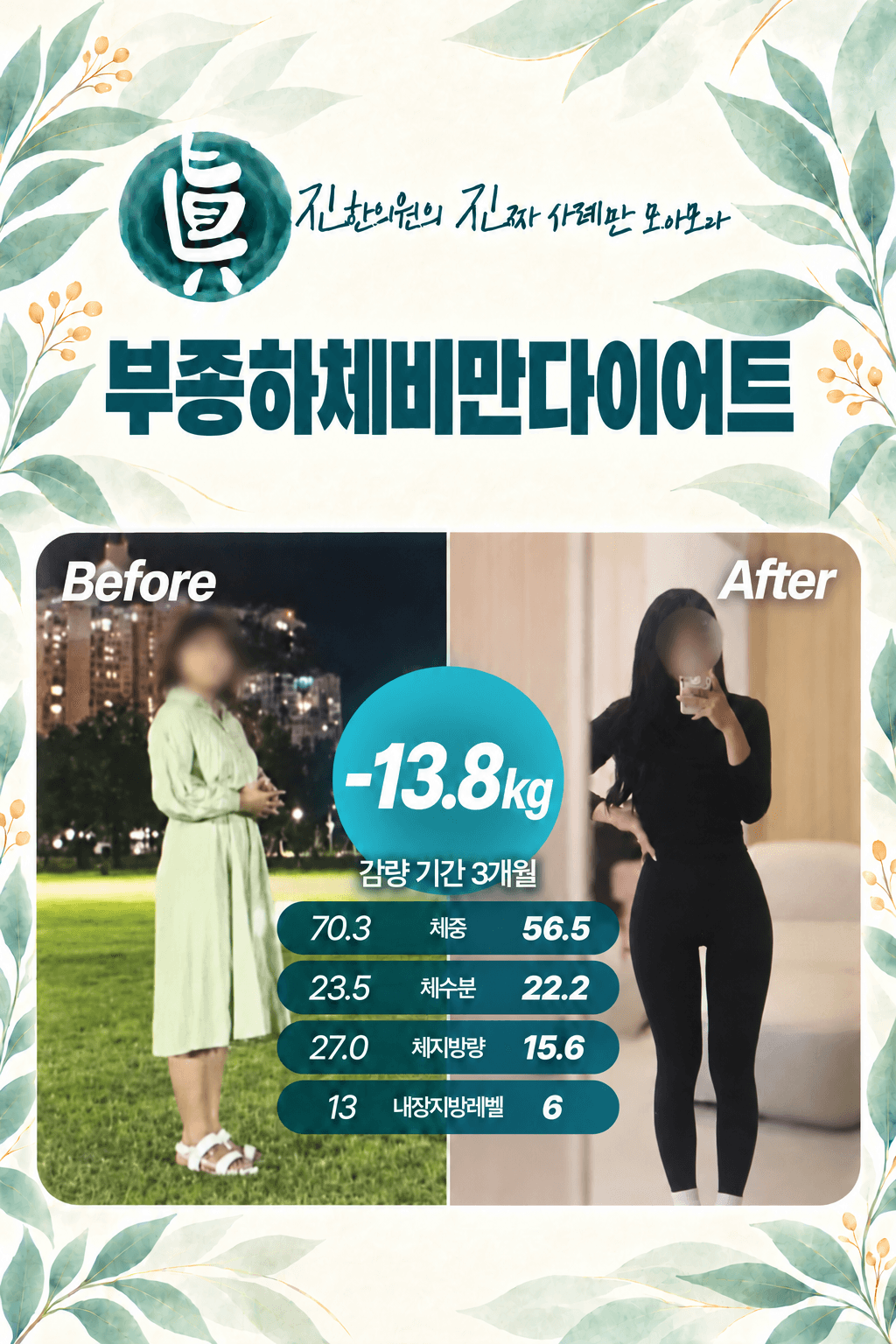 부종하체비만다이어트 -13.8kg 감량 사례
