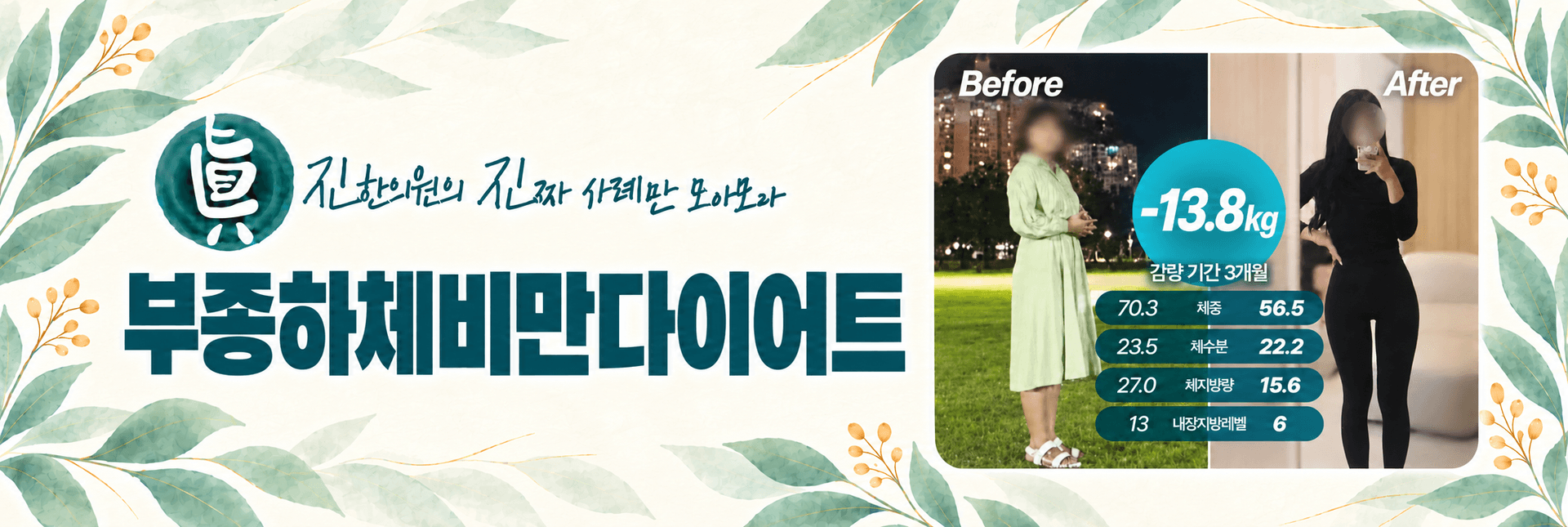 부종하체비만다이어트 -13.8kg 감량 사례