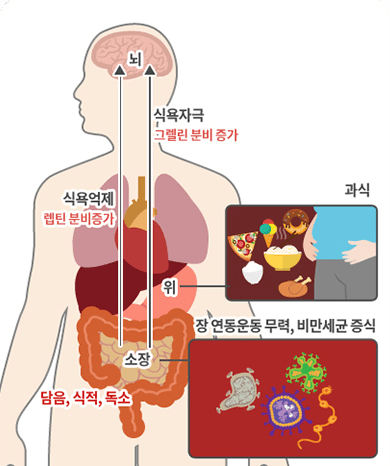 해독치료 전 비정상식욕
