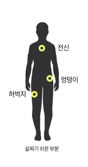 소음인 살찌기 쉬운 부위