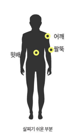 소양인 살찌기 쉬운 부위