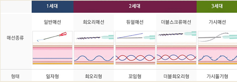 매선 세대별 특징