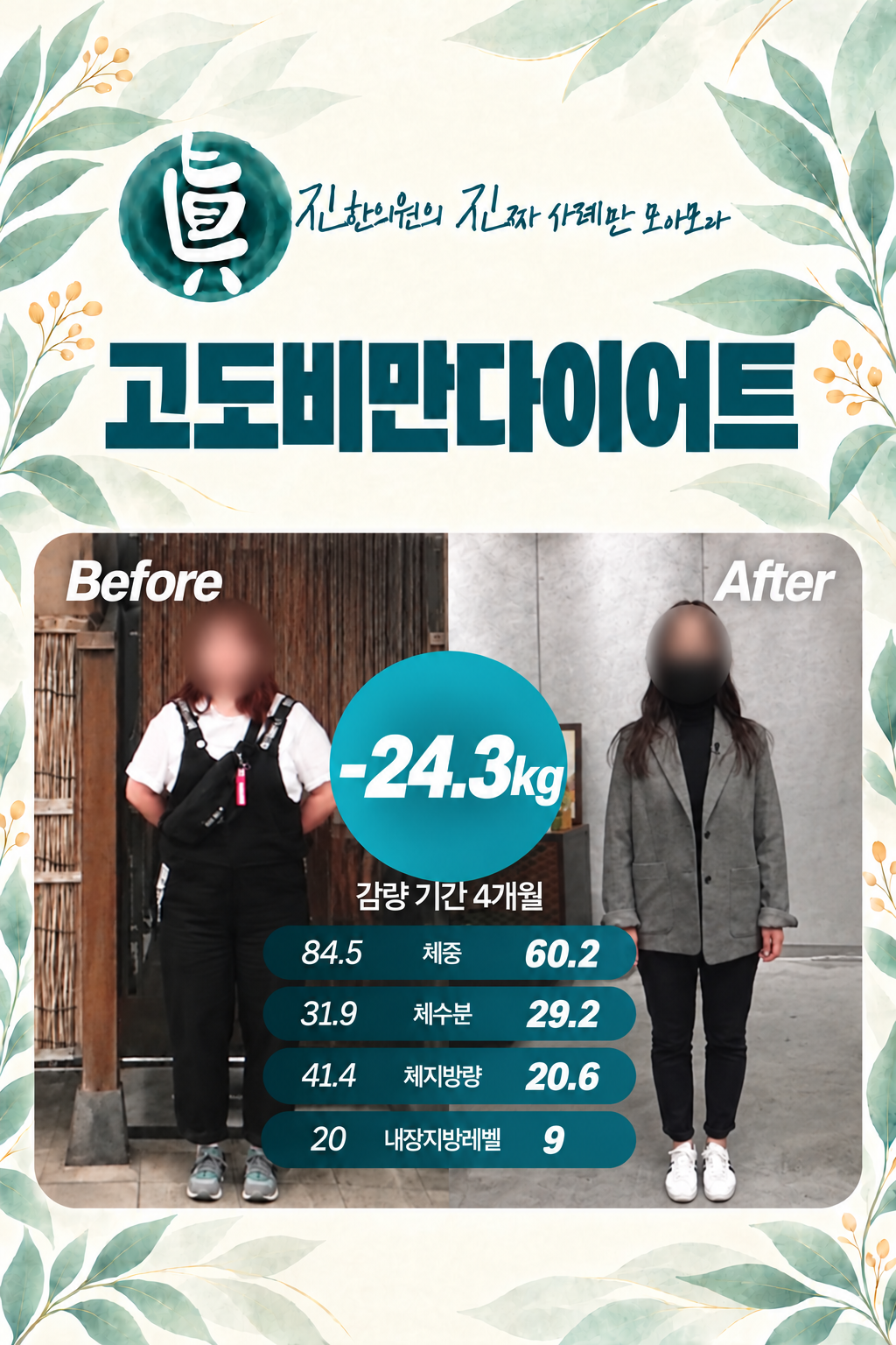 고도비만다이어트 -24.3kg 감량 사례