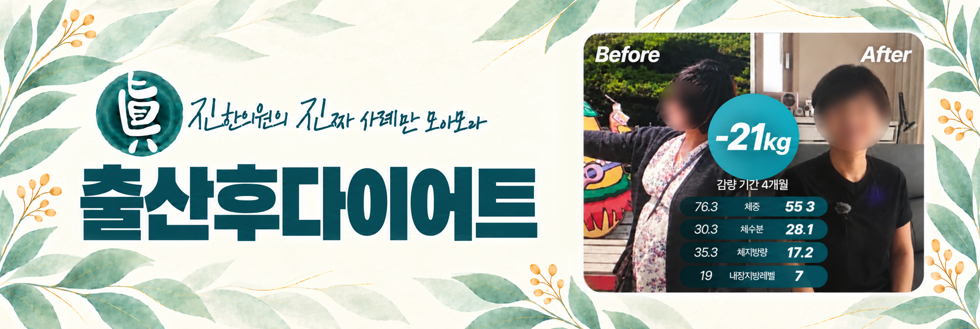 출산후다이어트 -21kg 감량 사례