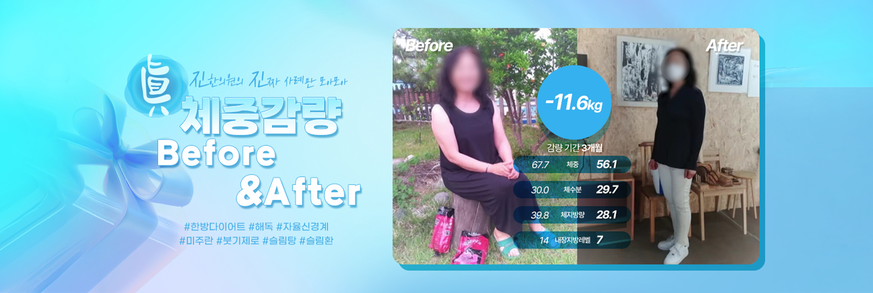 진한의원 배너 8