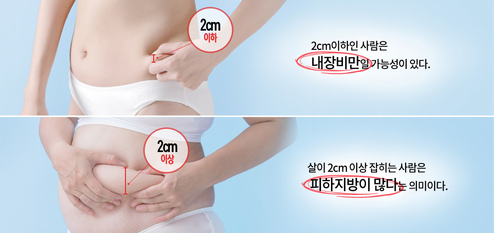 피하지방 내장지방 비교