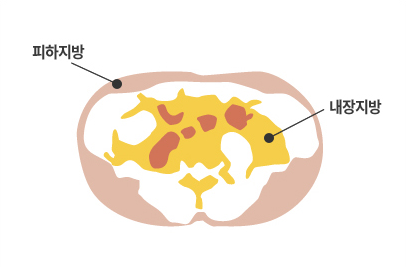 내장지방 정상 단면도