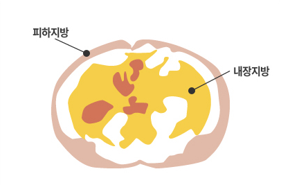 내장지방 과다 단면도