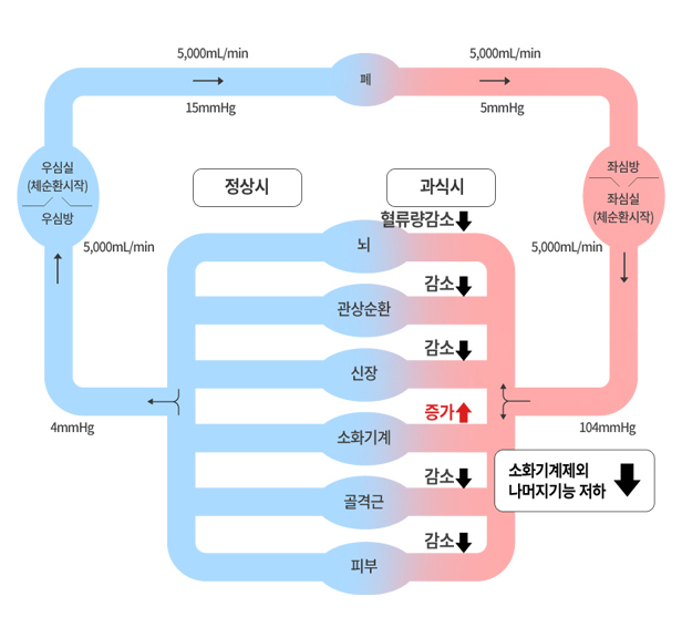 혈류 변화 프로세스 다이어그램