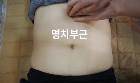 명치부근