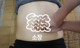 배꼽주위